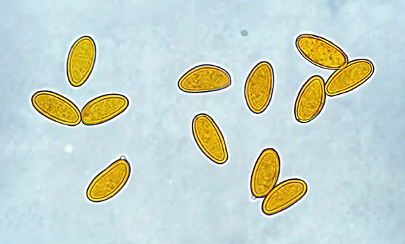 Spores de mérule au microscope
